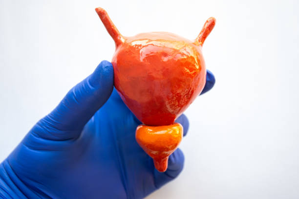 urólogo Guadalajara Jalisco