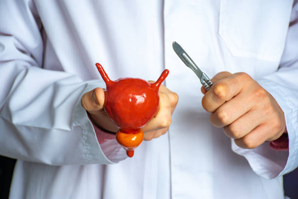 cirugía de próstata en Guadalajara