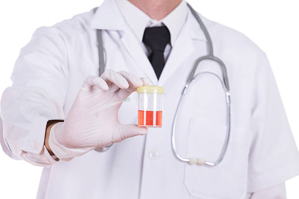 ¿El ardor y la sangre en la orina son síntomas claros de infección? sangre en orina