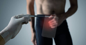 ¿Por qué la vasectomía sin bisturí causa menos inflamación y sangrado?