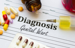 ¿Cómo saber si las verrugas genitales requieren atención médica inmediata?
