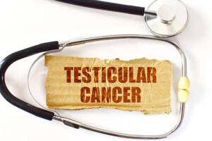 ¿Cómo diferencia el urólogo un tumor testicular benigno de una lesión maligna?