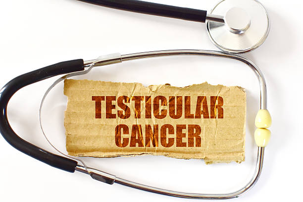 ¿Cómo diferencia el urólogo un tumor testicular benigno de una lesión maligna?