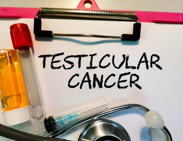 ¿Qué ocurre con el diagnóstico de un tumor testicular canceroso? ¿Qué ocurre con el diagnóstico de un tumor testicular canceroso?