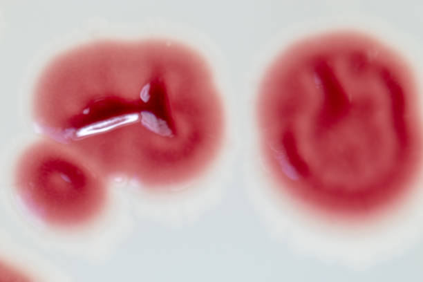 Hematuria macroscópica vs. microscópica: ¿cuál es la diferencia?